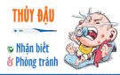 Tuyên truyền về bệnh thủy đậu: nguyên nhân và cách phòng tránh